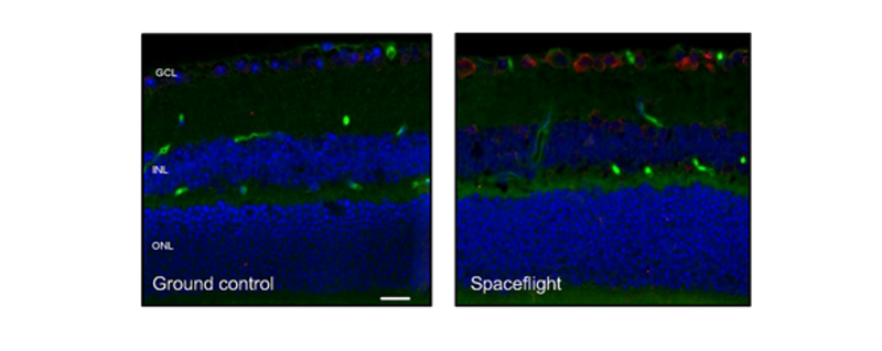 Research brief - Overbey et al